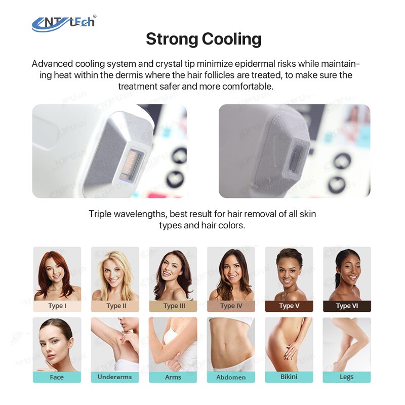 3-Wave Diode Laser - 755/808/1064nm Portable Professional Hair Removal Machine