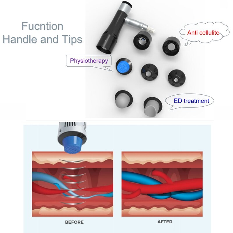 Shockwave Therapy Machine - Factory Sale Eswt Physiotherapy Equipment Device