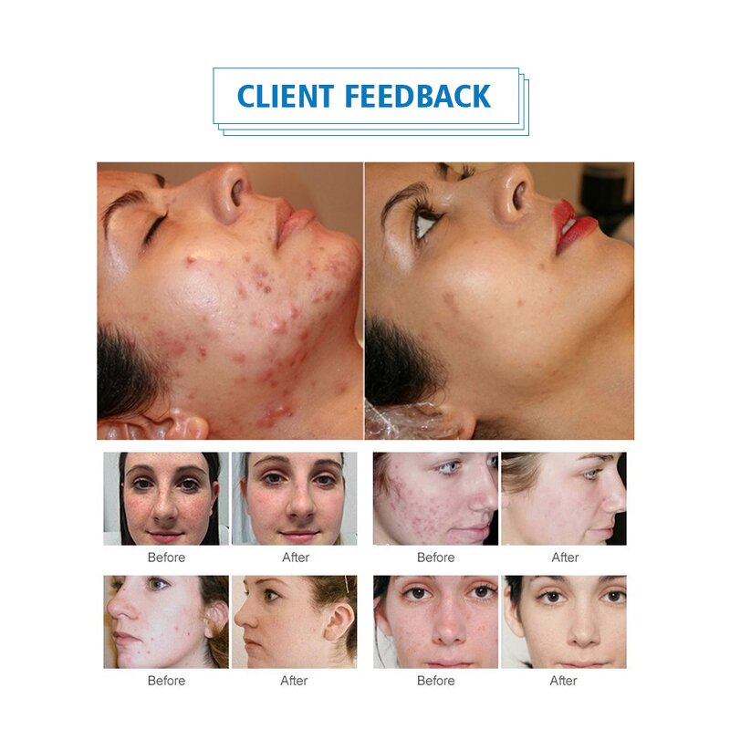 LED Red Light Therapy - 80/100/200w Newest Device for Home Use Beauty Salon