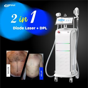 DPL Diode Laser Machine - Dye Pulsed Light Hair Removal Skin Rejuvenation Nir