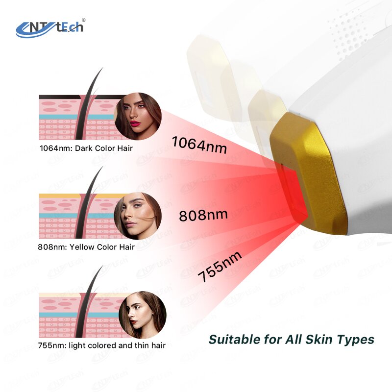 Diode Laser Epilation Machine - 755/808/1064nm Any Color Skin Hair Removal Device