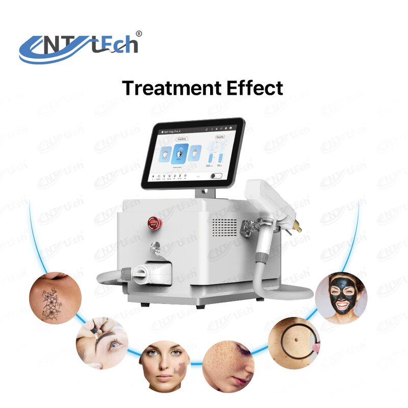 Nd Yag Laser Machine - American Hot Sale Carbon Laser Peel Tattoo Removing