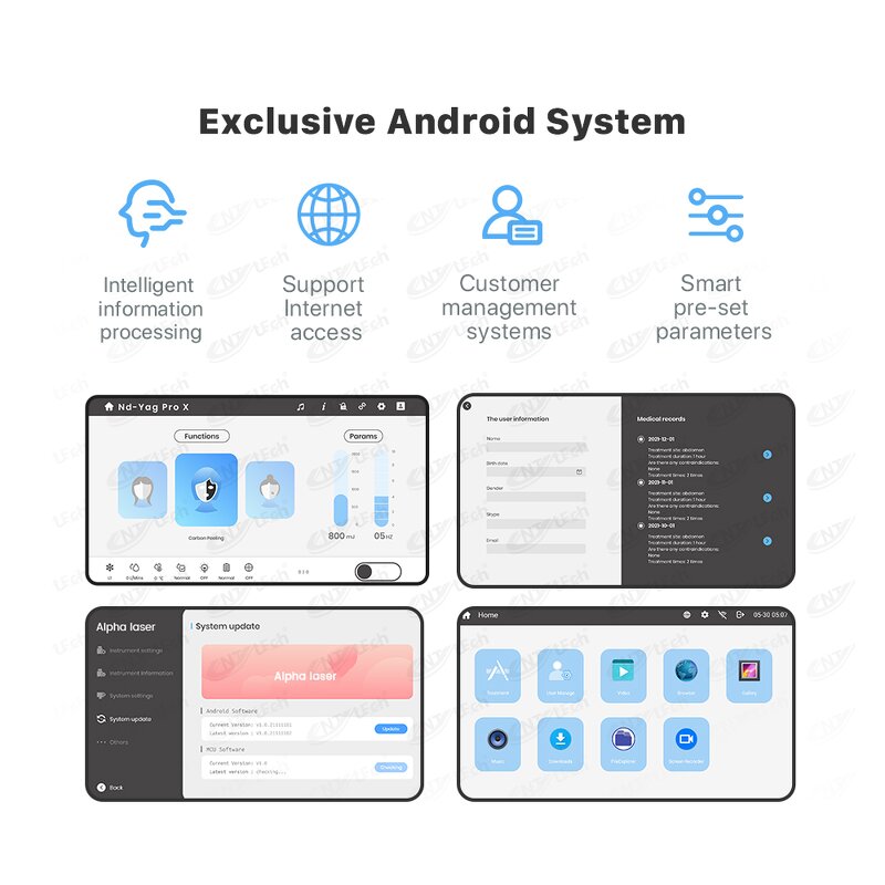 Q Switched Nd Yag Laser - Best Selling Tattoo Removal with Air Cooler Head