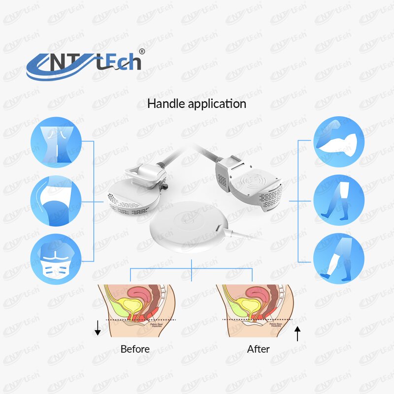 EMS RF Sculpting Machine - Professional Muscle Stimulator Burn Fat Slimming Device