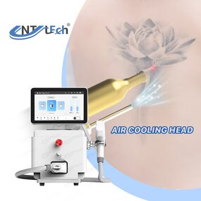 Q Switched Nd Yag Laser - Best Selling Tattoo Removal with Air Cooler Head