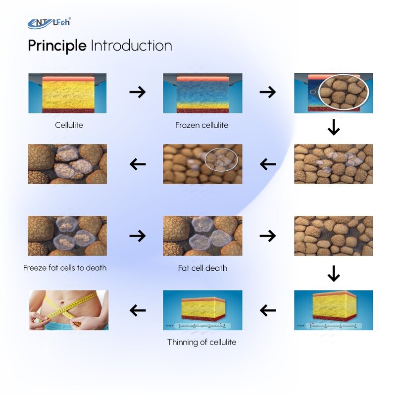 Cryo Therapy Machine - UNT 5 Handles Vacuum Cavitation 360 Body Sculpting