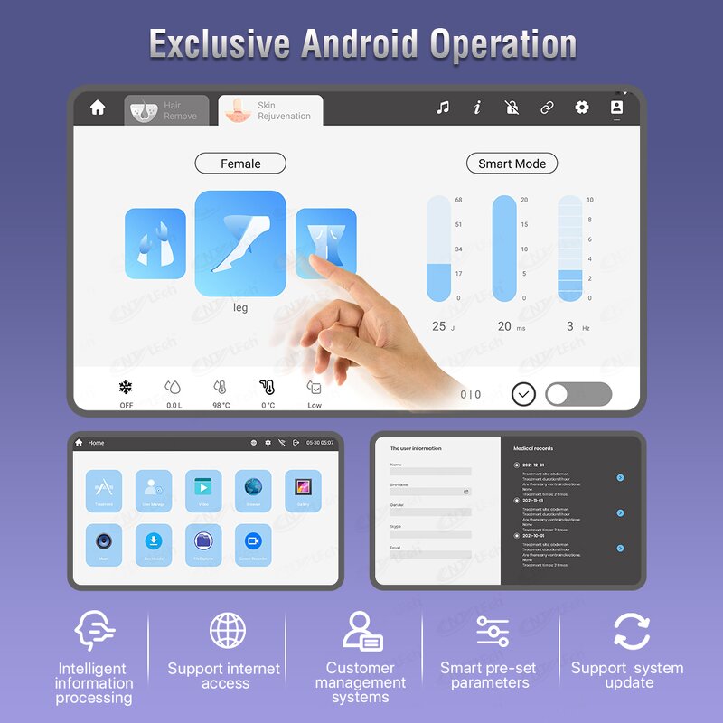 Diodenlaser Hair Removal - 1500w Triple Waves Professional Salon Machine