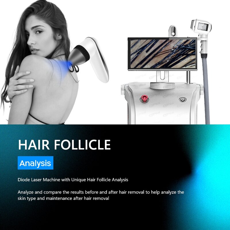 4-Wavelength Diode Laser - 2025 New 755/808/940/1064nm 800w Hair Removal Machine