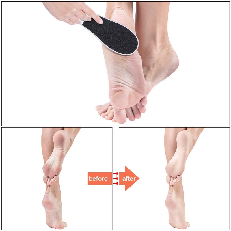 Plastic Foot File - Cheap Price Disposable Foot E Rasp Dead Skin Remover