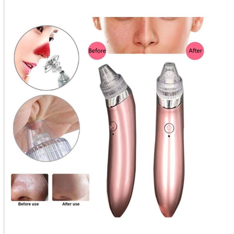 Vacuum Blackhead Remover - Rechargeable 4 Interchangeable Suck Heads Pore Cleaner