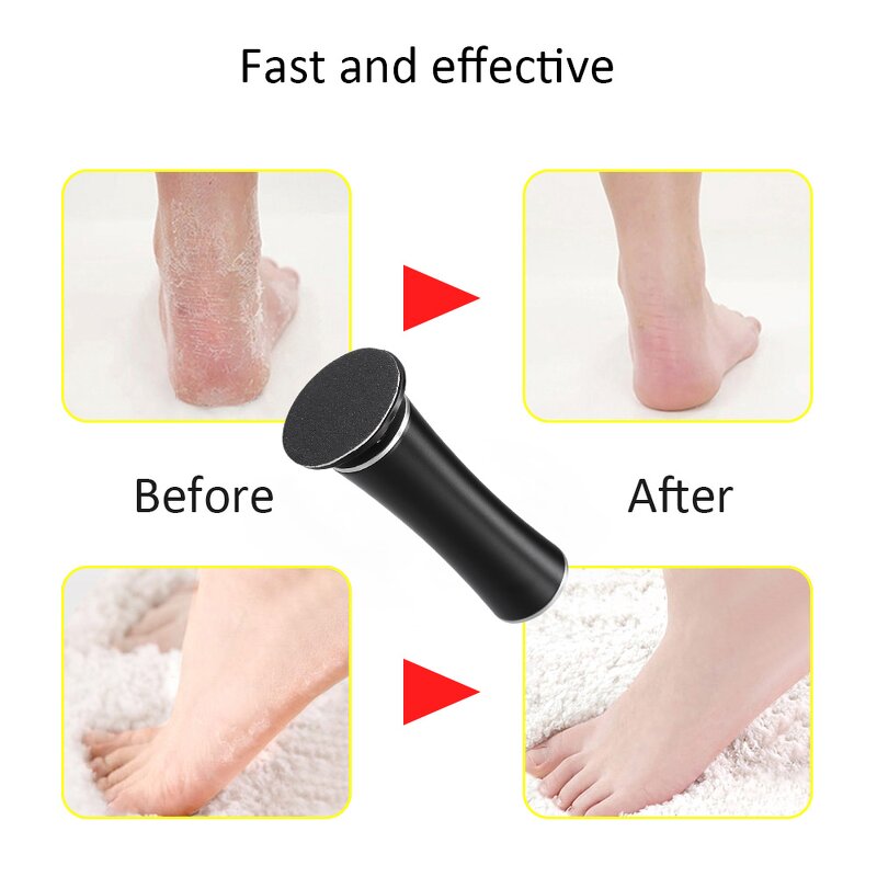 Electric Foot Callus Remover - New Style Professional Pedicure Foot File Tool