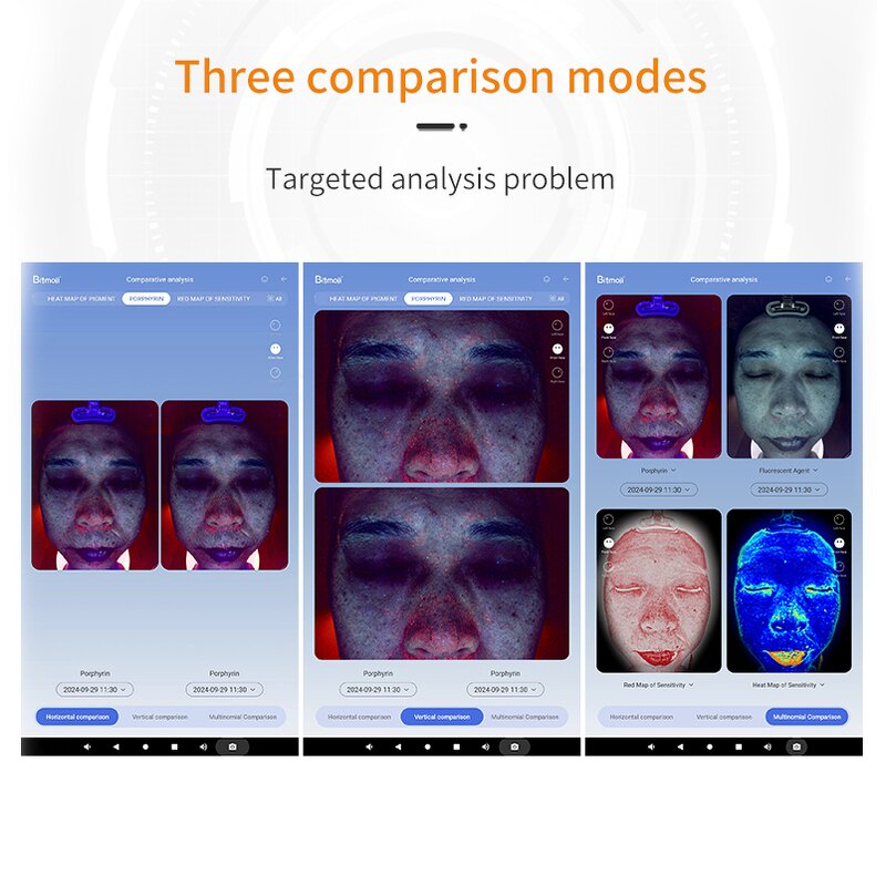 Skin Analyzer Machine Manufacturer - Portable Smart 3D Scanner Camera USB IT ZA US Plug