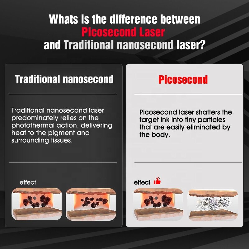 Pico Laser Machine Manufacturer - Picosecond Pico Lasering for Pigment & Tattoo Removal
