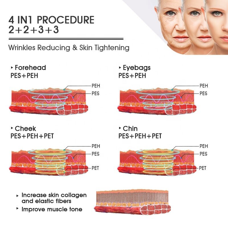 Facial Device Manufacturer - Electromagnetic Muscle Stimulation RF for Double Chin & Face Lift