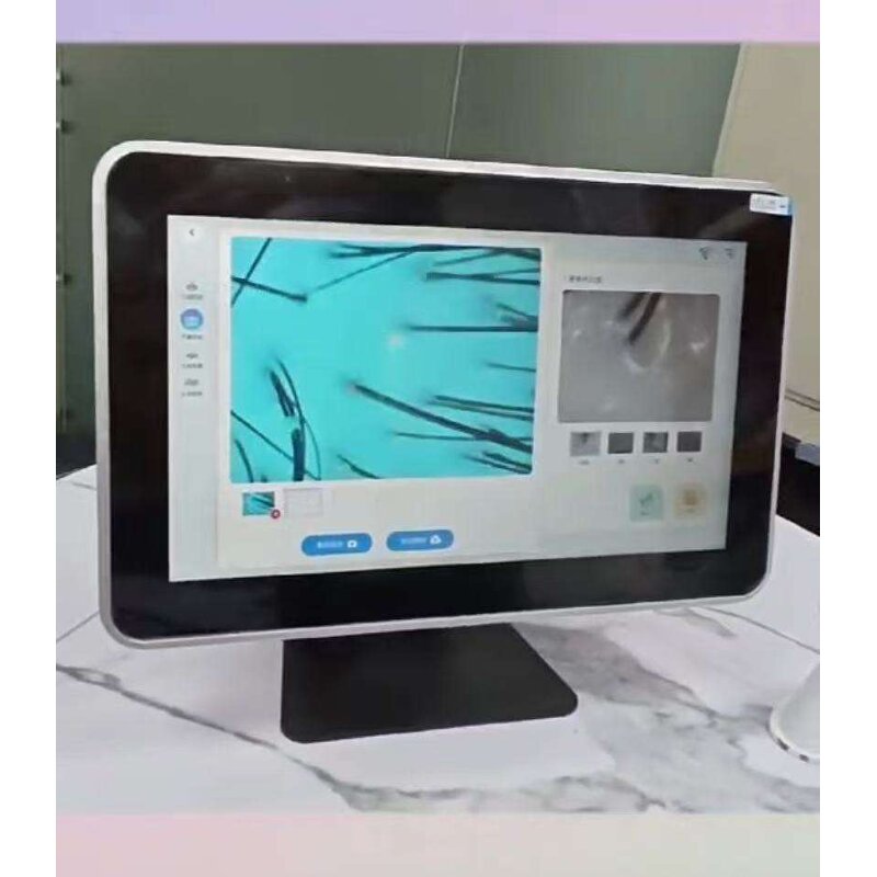 Hair Analysis Machine Manufacturer - AI Intelligent Smart Touch Screen with Operating System