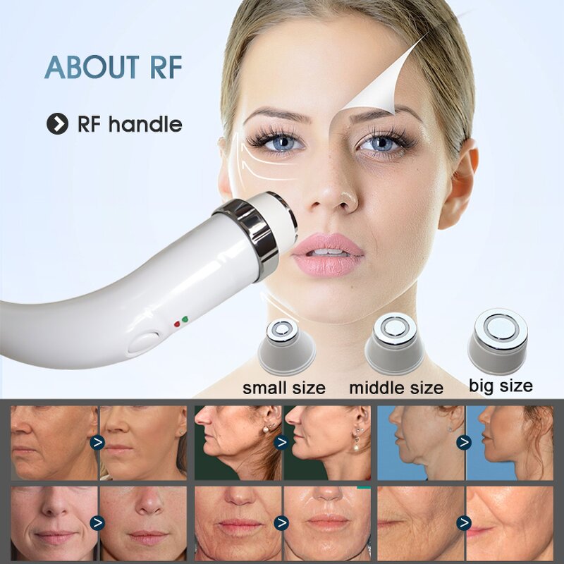 Laser Machine Manufacturer - 4 in 1 Multifunctional OPT IPL E-light Nd Yags 808nm Diode