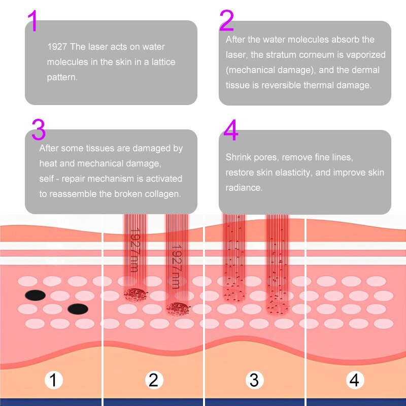 Fractional Laser Manufacturer - 1927nm Nonablative Subablative Thulium for Facial