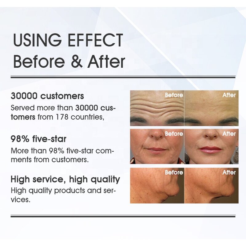 Face Muscle Sculpt Machine Manufacturer - EMSS Muscle Stimulation Wrinkle Removal RFING