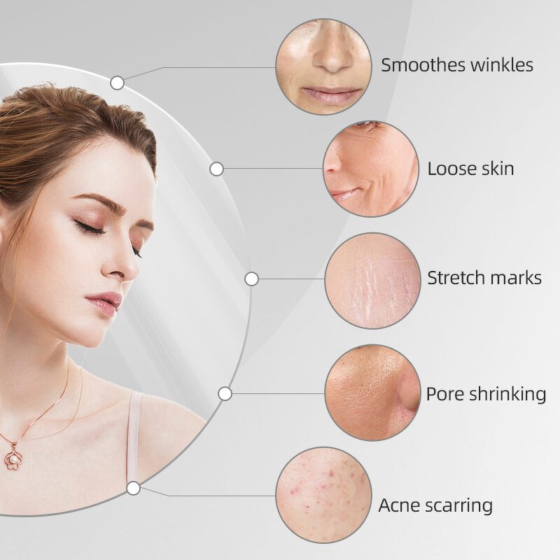 Derma Pen Manufacturer - Painless Electric Microneedles Adjustable Micro Needle for Face Home Use