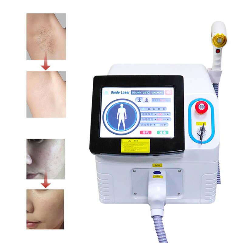 Laser Hair Removal Machine Manufacturer - Professional 808mn Diode Ice 810nm for Hair & Tattoo Removal