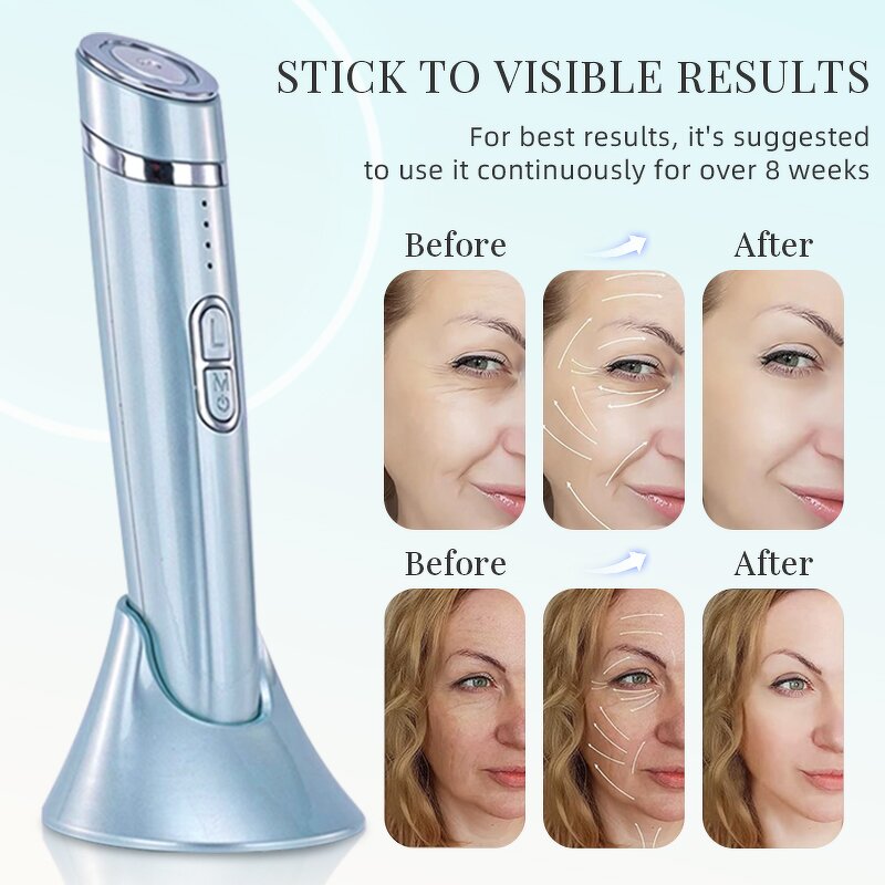 Eye Massage Tools Manufacturer - Skin Care Home Summer Massager Products for Eliminating Eye Wrinkles Beauty Device