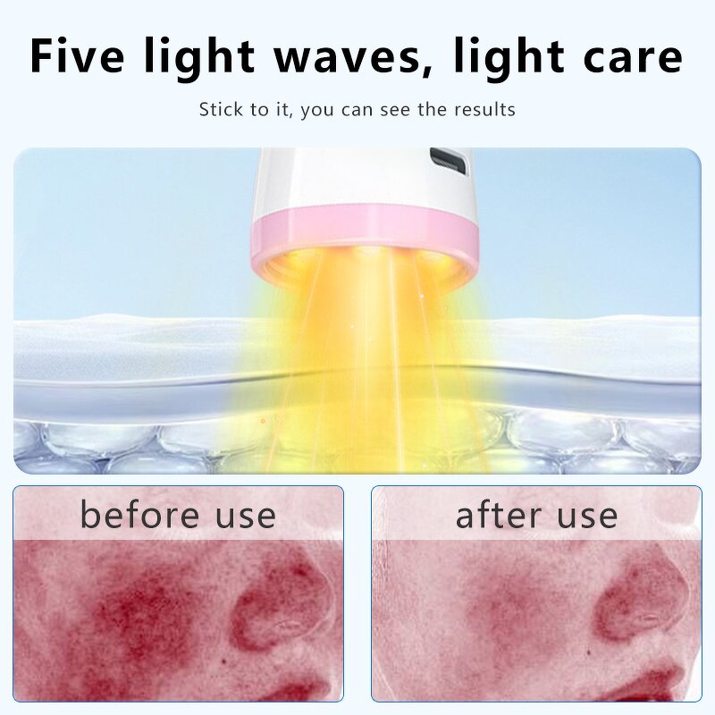 LED Facial Light Therapy Device Manufacturer - Hand Held Red/Blue/Green/Purple Home Use Skincare Wand
