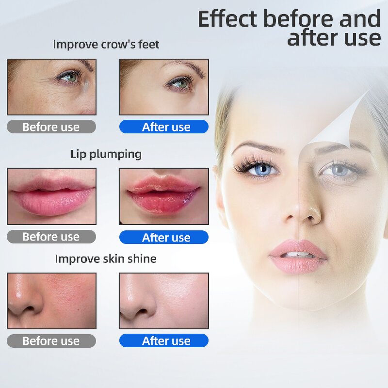 Hyaluronic Acid Pen Manufacturer - No Needle Liquid Inject Portable 0.5ml Ampoule Sterile Disposable for Face Care