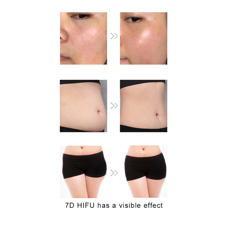 Facial Treatment Machine Manufacturer - Portable 7D for Face Lifting Skin Beauty for Salon