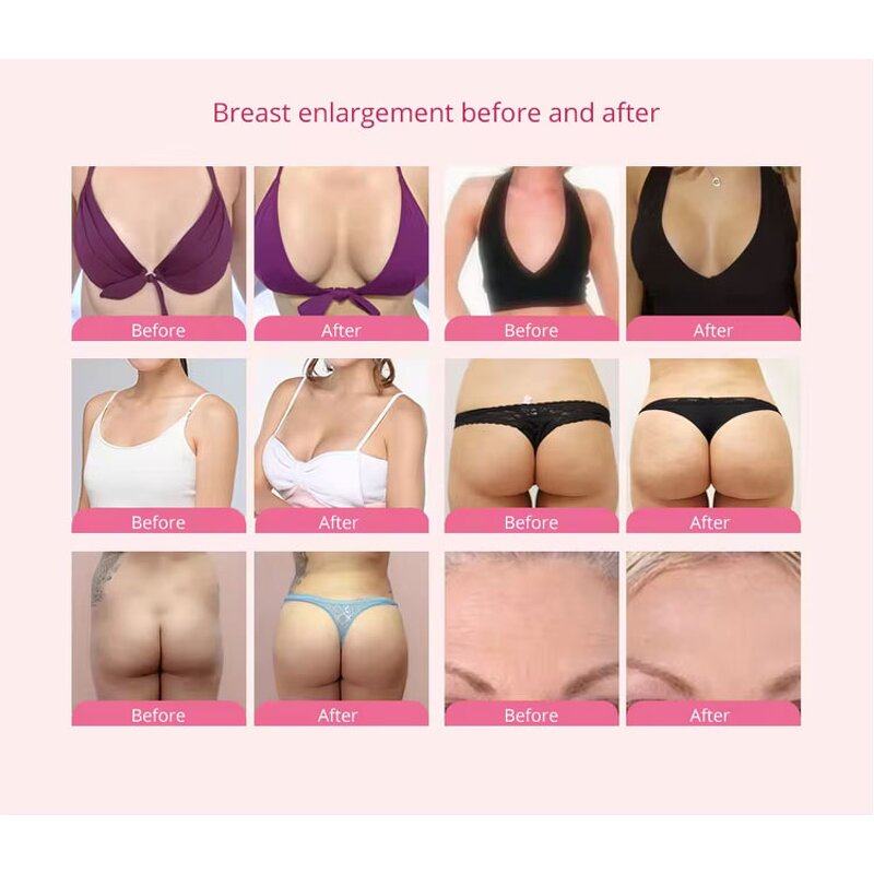 Breast Massager Manufacturer - New Electric for Breast Lifting Vacuum Pump Enlargement