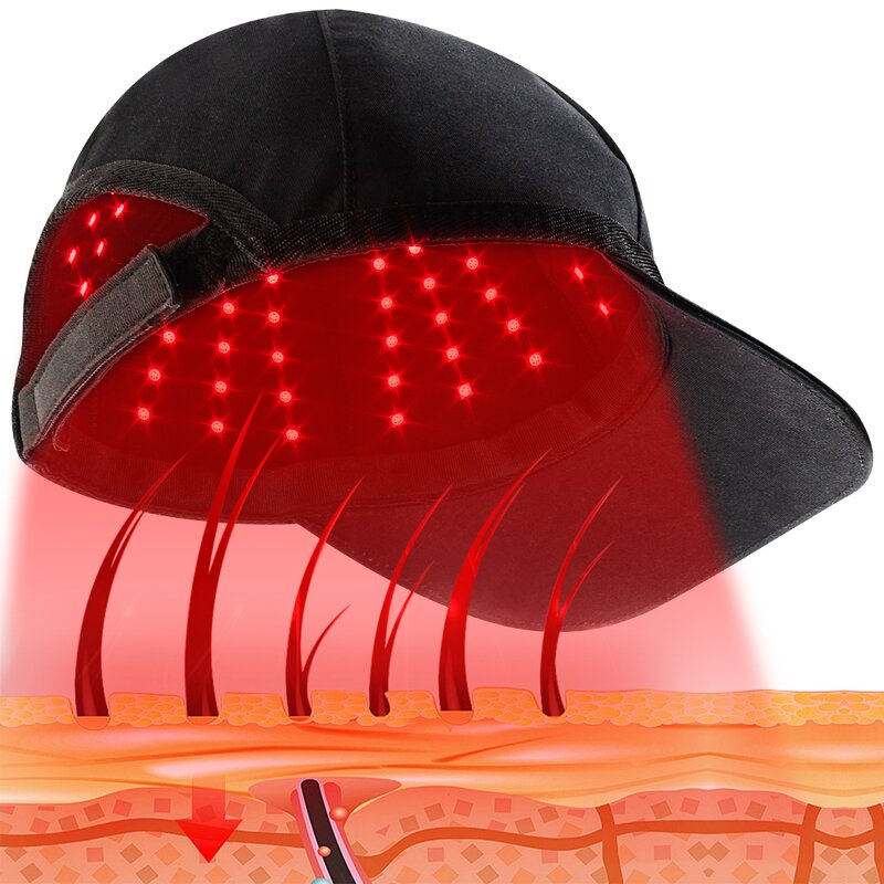 Red Light Therapy Helmet Manufacturer - 660nm 850nm Red Blue Hat for Hair Loss Regrowth