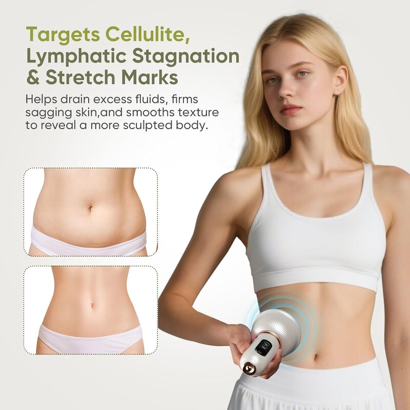 Anti Cellulite Massage Tool Manufacturer - Reduce Stretch Marks Legs Arms Belly Body Sculpting Machine