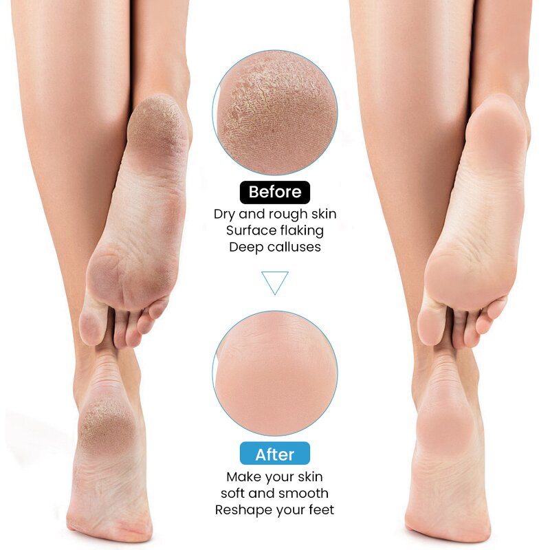 Electric Foot File Manufacturer - 2025 Professional Rechargeable Cordless Feet Callus Remover Machine