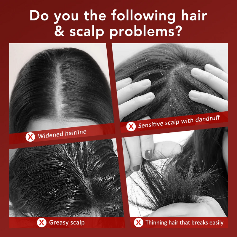 Hair Growth Comb Manufacturer - 660nm Red Led Micro Therapy Serum Applicator Vibrating Scalp Brush