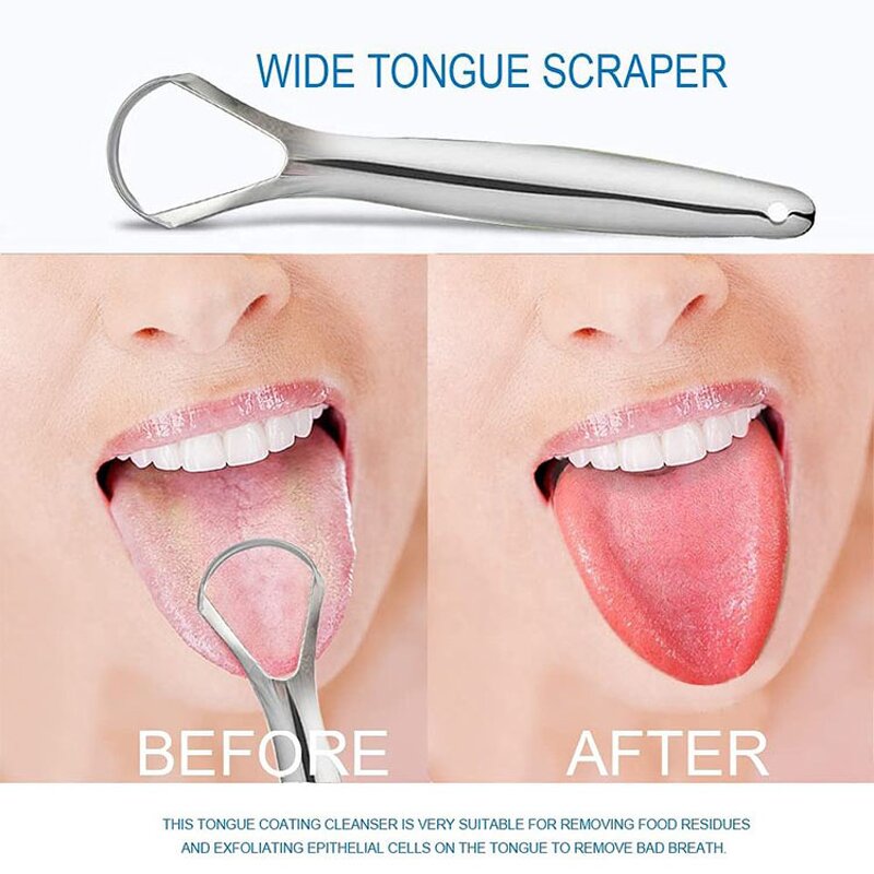 Tongue Cleaner Manufacturer - Factory Wholesale Stainless Steel Reduce Bad Breath Oral Care Tool With Travel Case