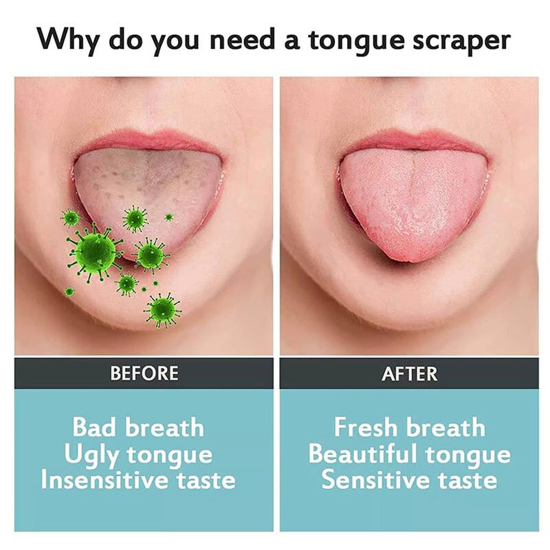 Tongue Scraper Manufacturer - High Quality Home Use Plastic Handle Stainless Steel Reusable Oral Care Cleaning Tool Scrubber