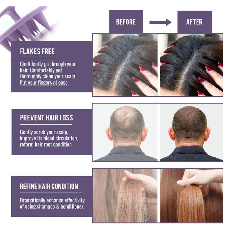 Silicone Shampoo Comb Manufacturer - Factory Soft Waterproof Head Health Care Dandruff Removal Hair Washing Scrubber Tool