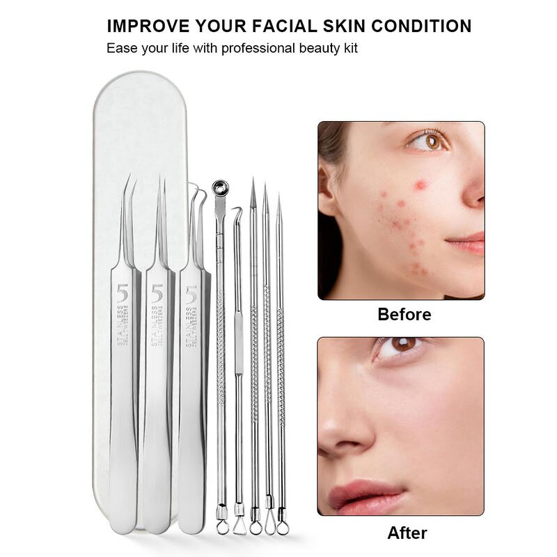 Pimple Popper Tool Kit Manufacturer - Hot Sell Professional Facials Spot Whitehead Blemish Acne Needle Extraction