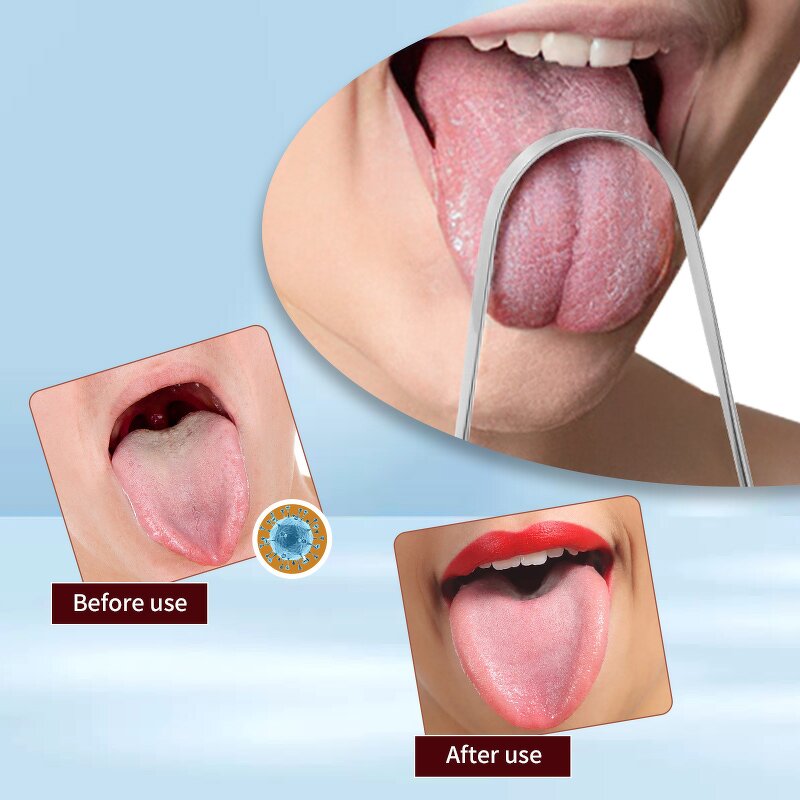 Tongue Cleaner Manufacturer - Custom Logo Stainless Steel Reduce Bad Breath Oral Care Tool with Ridges for Men Women