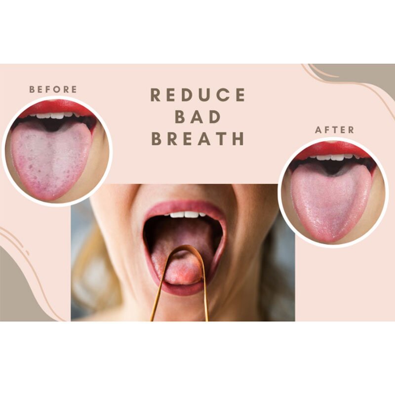 Tongue Cleaner Manufacturer - Wholesale Surgical Grade Stainless Steel Dental Oral Care Cleaning Tools Fresh Breath for Adults