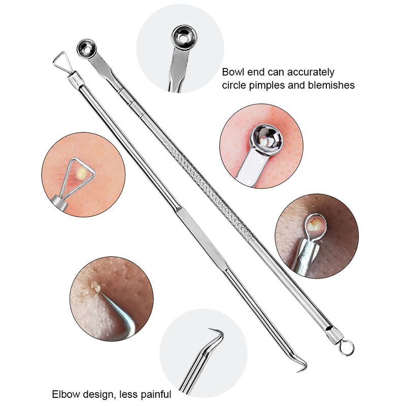 Pimple Popper Tool Kit Manufacturer - Hot Sell Professional Facials Spot Whitehead Blemish Acne Needle Extraction