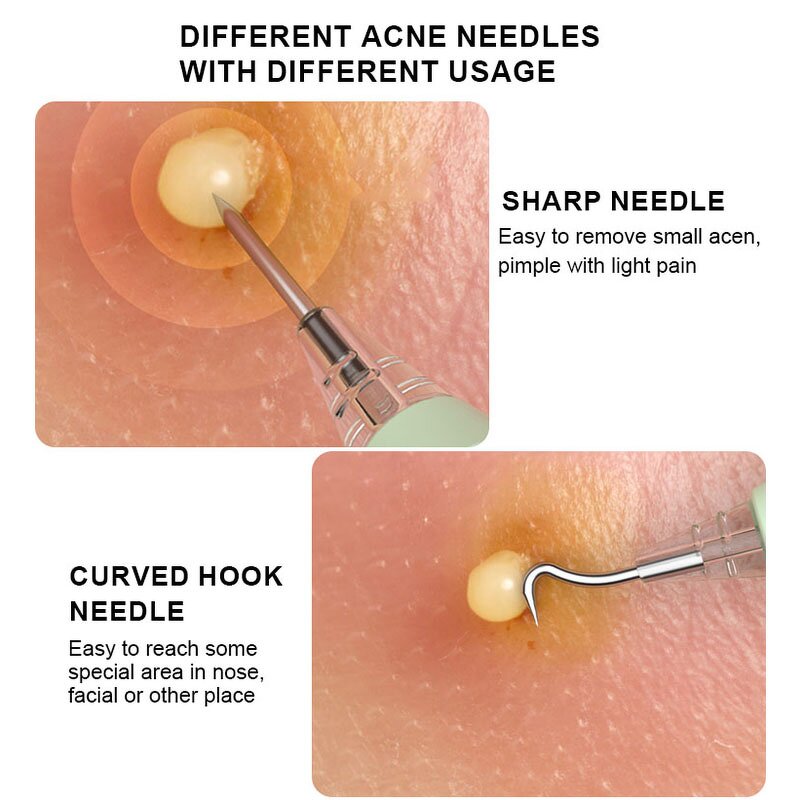 Electric Blackhead Removal Tool Manufacturer - Professional 5-in-1 Pimple Popper Face Acne Needle Comedone Extraction Kit with LED Light