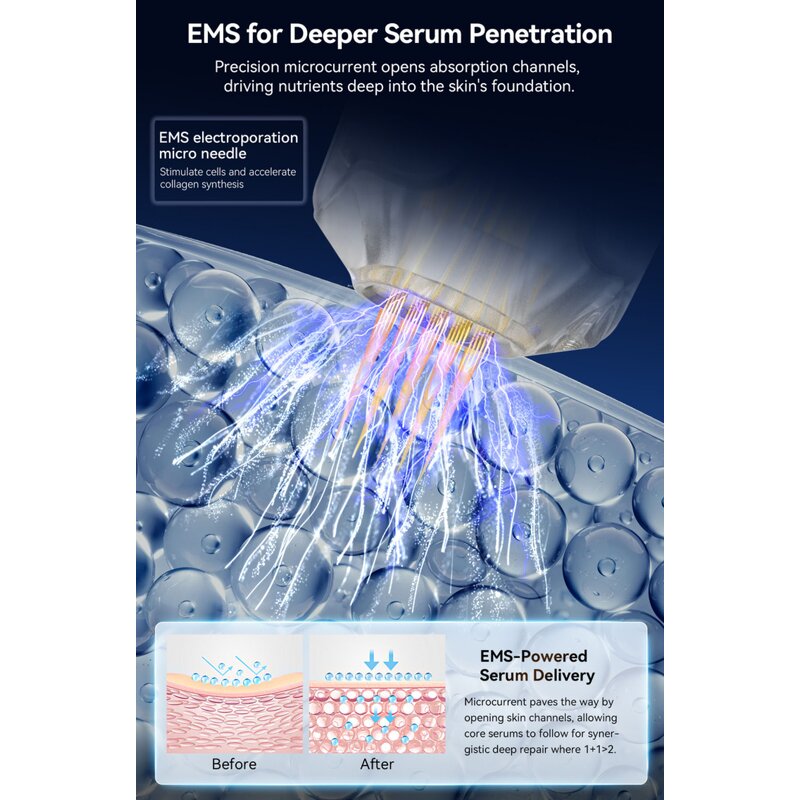 Liposonic Cartridge Manufacturer - Replacement Cartridge for Body Contouring Slimming Machine