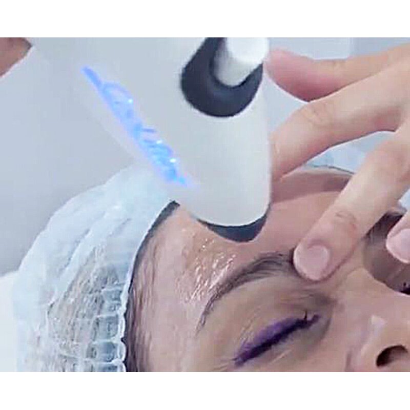 Diamond Dermabrasion Machine Manufacturer - 3 in 1 Strong Power Suction Spray Skin Rejuvenation Device