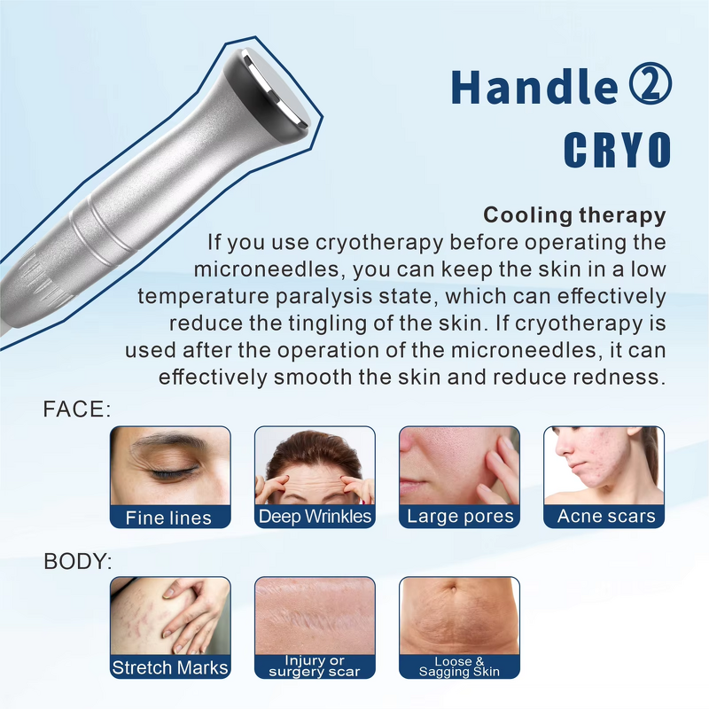 Gold RF Microneedle Hifu Machine Manufacturer - 2 in 1 7D High Intensity Focused Ultrasound Wrinkle Remover