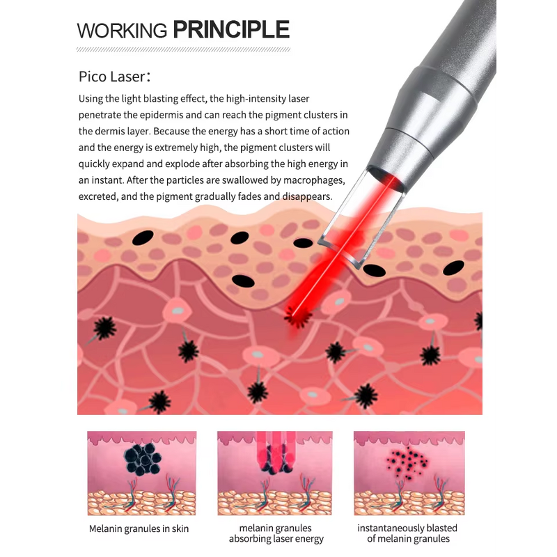 Multi-function Laser Machine Manufacturer - 10/12 Bar IPL 808nm Diode Picosecond RF Hair Tattoo Removal