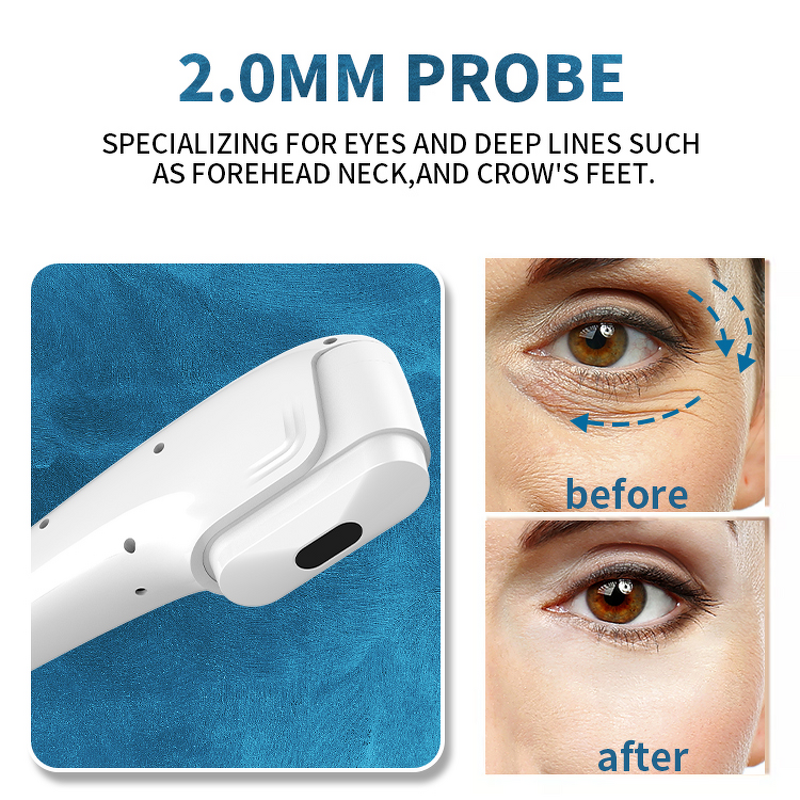 7D Hifu Machine Manufacturer - High Intensity Focused Ultrasound Facial Wrinkle Removal Skin Rejuvenation Device