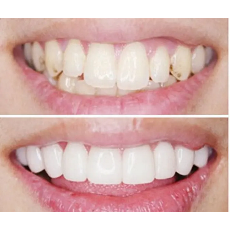 Luer Lock Connector Manufacturer - Hot Sale Sterilized Syringe Rapidfill Connector