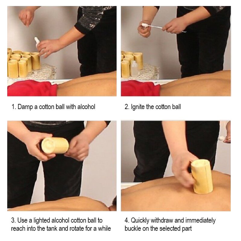 Hijama Cupping Set Manufacturer - Chinese Massage Bamboo