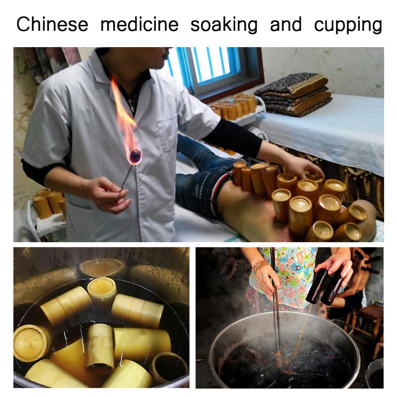 Hijama Cupping Set Manufacturer - Chinese Massage Bamboo