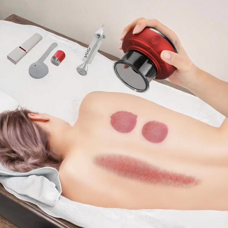 Electric Cupping Therapy Device Manufacturer - Wholesale Hijama Cups Machine for Body Vacuum Massage